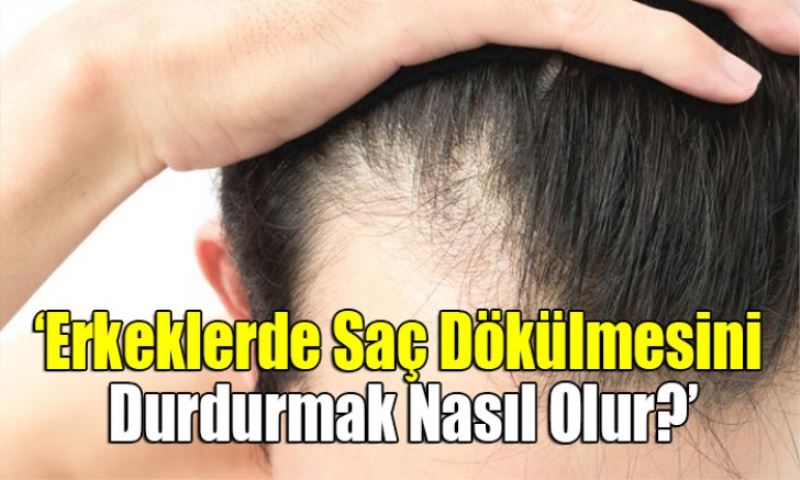 Erkeklerde Saç Dökülmesini Durdurmak Nasıl Olur?